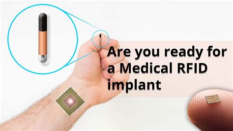 are rfid chips real|Human Microchipping: An Unbiased Look at the Pros and Cons.